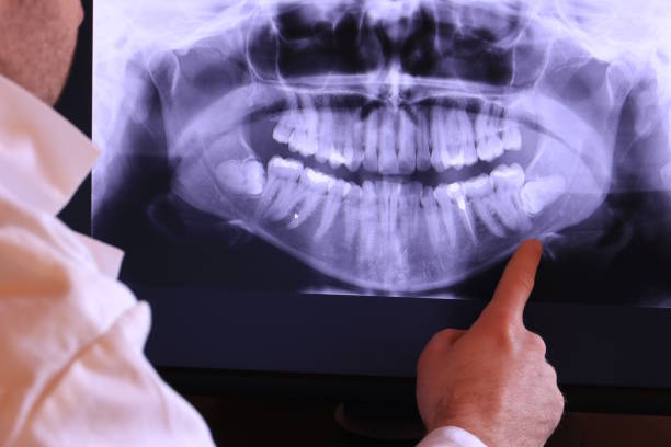 Best Emergency TMJ Treatment in Holtville, AL